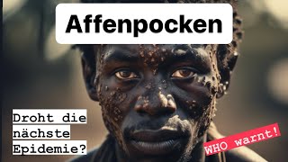 ￼😳AFFENPOCKEN! WHO ruft höchste Alarmstufe aus! DROHT uns die nächste Epidemie? Oder PANIKMACHE?😷