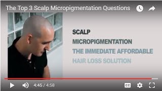 The Top 3 Scalp Micropigmentation Questions