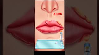 Lip Surgery asmr // Oddly Satisfying // Satisfy Your Heart #shorts