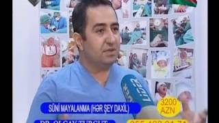 SÜNİ MAYALANMA HƏR ŞEY DAXİL  ƏN UCUZ QİYMƏTƏ - DR.OLCAY TURGUT