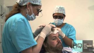 Head Quarters Hair Transplant Clinic, Halifax, NS