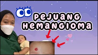 Pejuang Hemangioma pada bayi #hemangioma