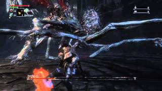 Bloodborne - #HypeHammer vs Defiled Amygdala