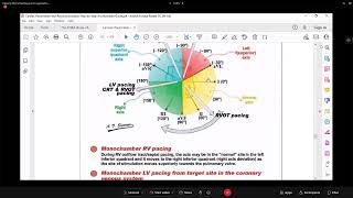 Biventricular Pacing and Cardiac Resynchoronization   Dr  Mohamed Bayoumi