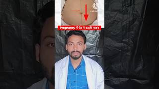 Pregnancy | प्रेगनेंसी में काली लाइन क्यों होती है | #pregnancy  #pregnancyscar #doctor #medicinetak