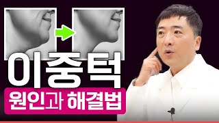 이중턱 살 처짐 원인과 성형 수술적 해결책, 이 두 가지를 함께해야 이중턱 없앨 수 있습니다 - 연세UP성형외과