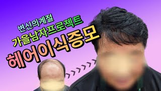 (시술영상편)남자의 변신은 무죄! 헤어이식증모의 끝은 자신감!