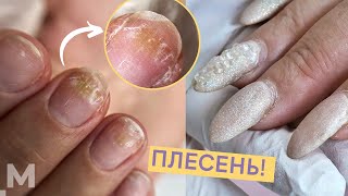 ПЛЕСЕНЬ НА НОГТЯХ: ЛАЙФХАК 😜 СПЛОШНЫЕ ОТСЛОЙКИ и ТРЕЩИНЫ 😱Как лечить плесень под гель лаком.