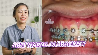 ARTI WARNA BRACKET BEHEL & GIGI GOYANG