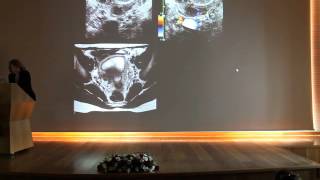 Pitfalls in Female Pelvic Imaging - Corinne Balleyguier