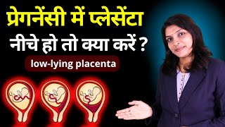 Low lying placenta हो तो गर्भवती क्या करें? #lowlyingplacenta