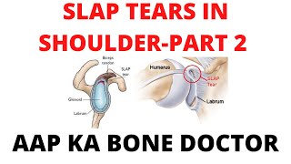 SLAP TEARS IN SHOULDER - PART 2 - EPISODE 6