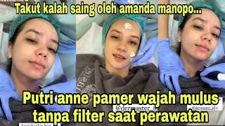 Takut kalah saing oleh amanda manopo...Putri anne pamer wajah mulus tanpa filter saat perawatan