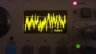 ER-301 into Makenoise Mimeophon glitch