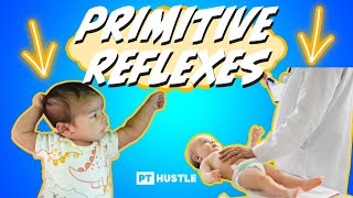 NPTE Video Question - Primitive Reflexes