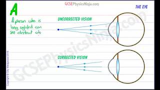 Long Sighted Vision Correction - Physics of Light