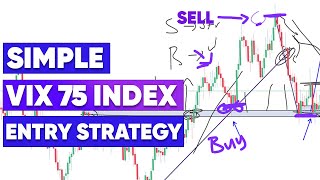 Vix 75 Entry Strategy