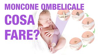 Come prendersi cura del moncone ombelicale del neonato - I consigli dell'ostetrica