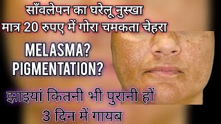 Home remedy For Hyper Pigmentation|रंग गोरा करें घर के रसोई से मात्र 20 रुपए में, सिर्फ 3 दिन में!