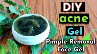 DIY Acne/Pimples Gel | Remove Acne Or Pimples | Pimple Removal Face Gel | पिम्पल्स को हटाए