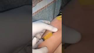 intravenous injection #injection #doctor