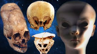 ESTOS CRÁNEOS NO DEBERÍAN EXISTIR - ¿Alienígenas o Seres Híbridos