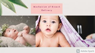 Mechanism of Breech Delivery