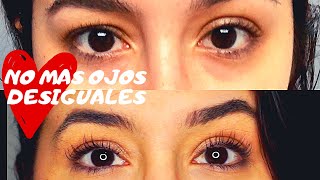 HOW I FIXED MY UNEVEN EYES- Parpados y Ojos Desiguales - Como los arregle? - Fibroblast