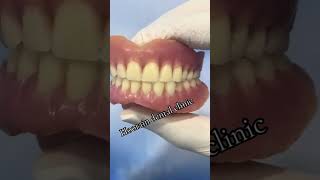 Soft full liner Denture