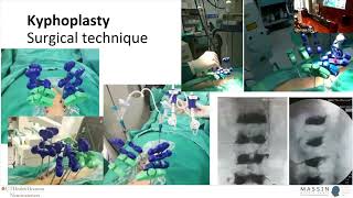 Vertebroplasty or Kyphoplasty? | MASSIN Congress Day 2 | Session 6, Talk 3