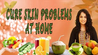 CURE SKIN PROBLEMS AT HOME II KITCHEN BEAUTY II JYOTIKA SHARMA II FUNKYARD