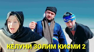 ОКИБАТИ КЕЛУНИ ЗОЛИМ КИСМИ 2