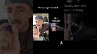 I need this surgery 😬 #tiktok