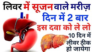 लिवर वाले मरीज, दिन में 2 बार इसको पी लो | Liver me sujan, liver damage symptom, liver kharab hindi