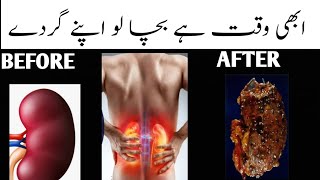 Healthy Kidney Tips| Natural Remedies