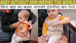 Baby without arm, will Inspire the world