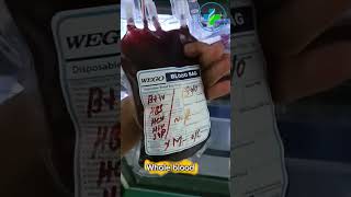 Whole blood | blood donation | blood bank transfusion medicine | blood bank | Fresh blood