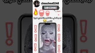 مين لي عندو فوبيا ثقوب يرفع ايده✋