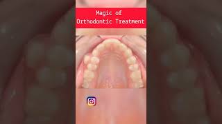 See what your orthodontist Can do