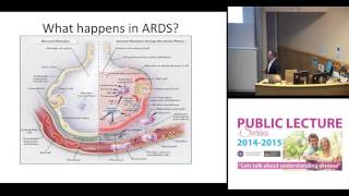 Treating injured lungs by extinguishing inflammation