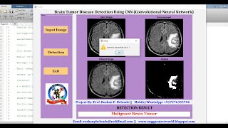 Brain Tumor Detection Using CNN Convolutional Neural Network | Tumor Classification Matlab Project