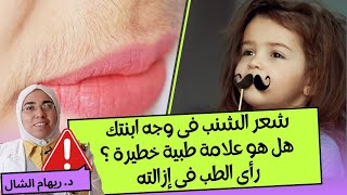 شعر الشنب فى وجه ابنتى 👧كيف اتصرف و احميها ✋️|د. ريهام الشال