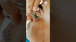 आँख के रोग में लाभ के लिए। नयन नैति का अभ्यास।#eyes cleaning #yoga #eyes servicing #shortvideo