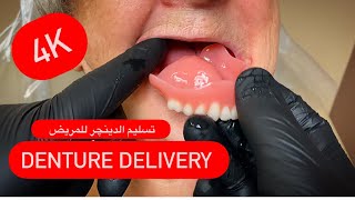 4K PROCESSING DENTURES WITH IVOCAP عربي/انكليزي  #WAXBAE #IVOCAP #DENTURES