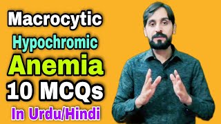 Macrocytic Normochromic Anemia MCQs | In Urdu/Hindi | 10 MCQs | MLT MCQs