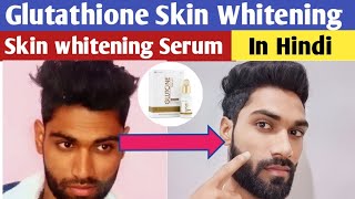 Glutathione Serum Review | Glutathione Before and After