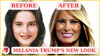 Melania Trump's New Look: Plastic Surgery Analysis | Who Died Today 2024