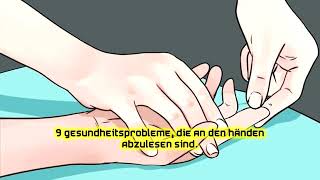 9 Gesundheitsprobleme, die an den Händen abzulesen sind