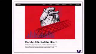 The changing paradigm of coronary artery disease treatment from angiography to physiology