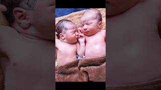 Adorable Twin Newborn Babies First Cry @AfterBirth